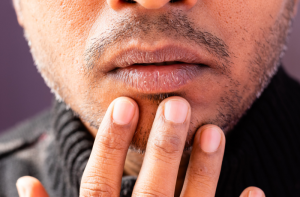 Dudak Çatlamasını Önlemenin Yolları