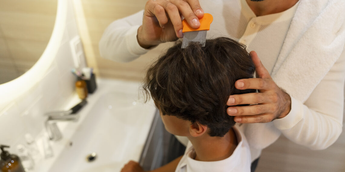 Çocuğunuzun Saçında Bit Var mı? Evde Yapabileceğiniz 5 Basit Test