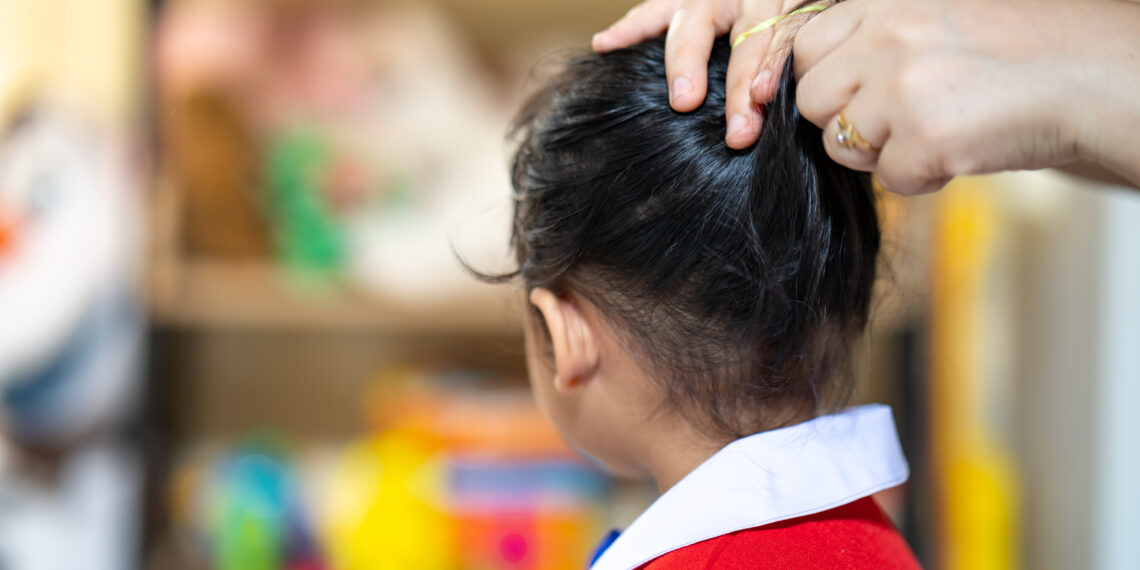 Çocuklarda Bit Sorununa engwl için düzenli kontroller yapılmalıdır.