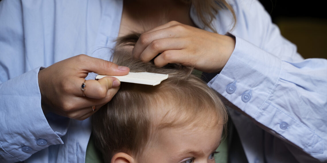 Okulda Bit Salgını Çıktığında Velilerin En Çok Sorduğu 10 Soru