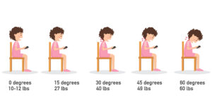 Boyun Kamburunuzdan Kurtulmak Mümkün mü?
