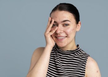 Komedonlara Karşı En Güçlü İkili: Salisilik Asit ve Retinol'ün Mucizevi Etkisi