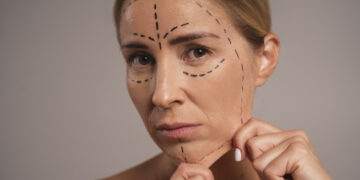 Botoks Molası: Ne Zaman Verilmeli, Ne Kadar Sürmeli?