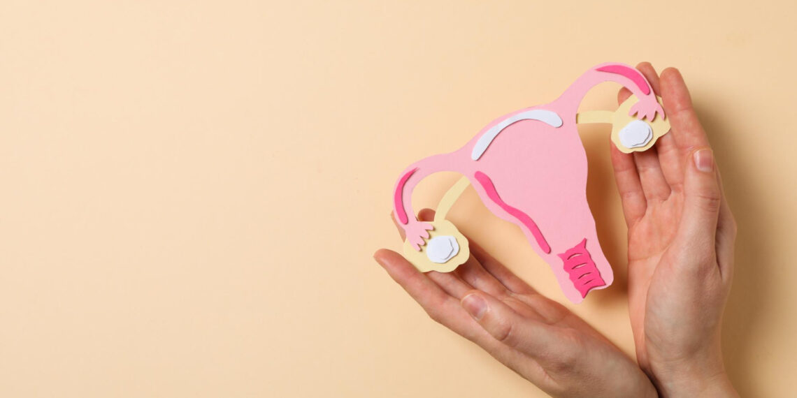 PKOS Yönetimi İçin 4 Temel Adım