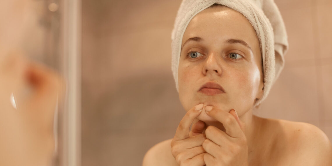 Cildim Bozuldu Ama Kullandığım Ürünler Aynı